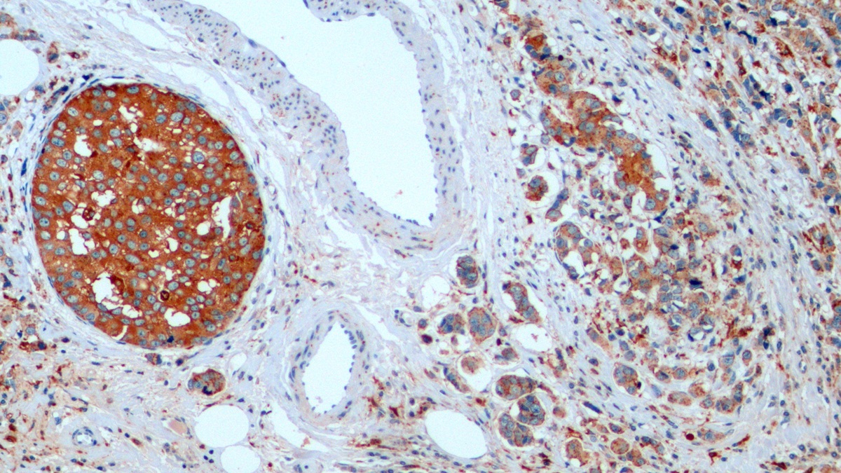 Monoclonal Antibody to Cathepsin D (CTSD)