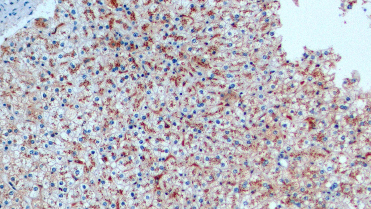 Monoclonal Antibody to Cathepsin D (CTSD)