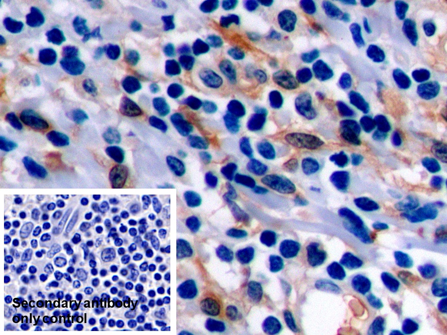 Monoclonal Antibody to Beta Actin (ACTB)