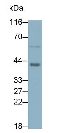 Monoclonal Antibody to Beta Actin (ACTB)