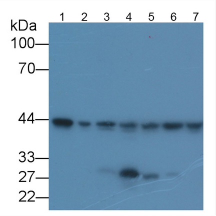 Monoclonal Antibody to Beta Actin (ACTB)