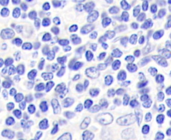 Monoclonal Antibody to Beta Actin (ACTB)