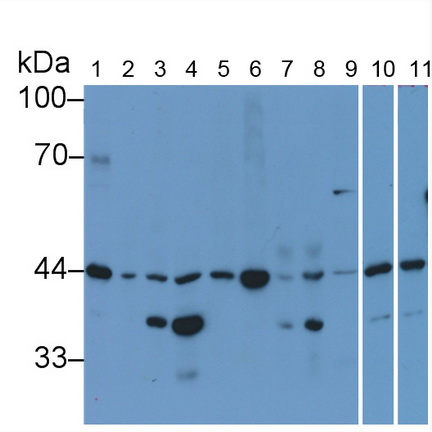 Monoclonal Antibody to Beta Actin (ACTB)