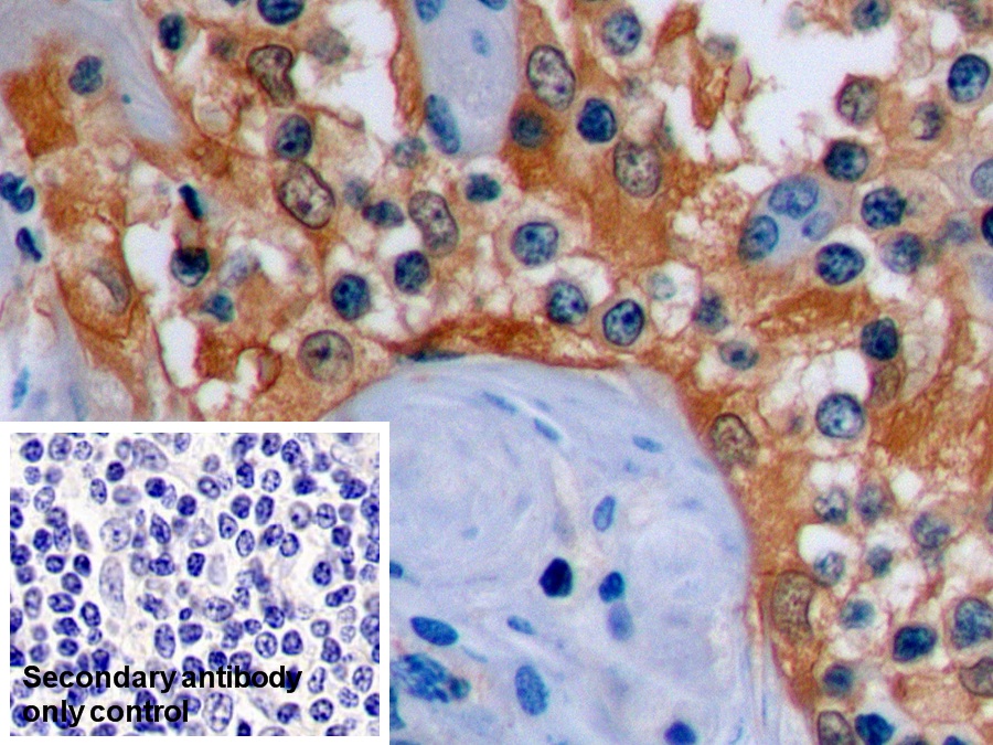 Monoclonal Antibody to Beta Actin (ACTB)