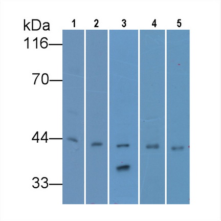 Monoclonal Antibody to Beta Actin (ACTB)