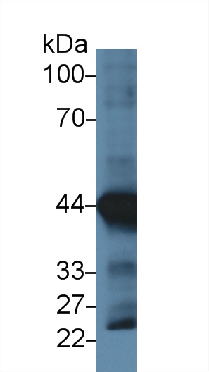 Monoclonal Antibody to Actin Alpha 1, Cardiac Muscle (ACTC1)