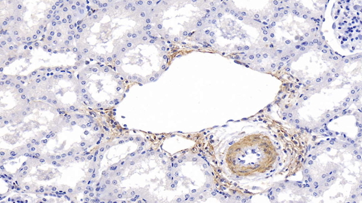 Monoclonal Antibody to Actin Alpha 1, Cardiac Muscle (ACTC1)