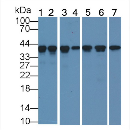 Monoclonal Antibody to Actin Alpha 1, Cardiac Muscle (ACTC1)