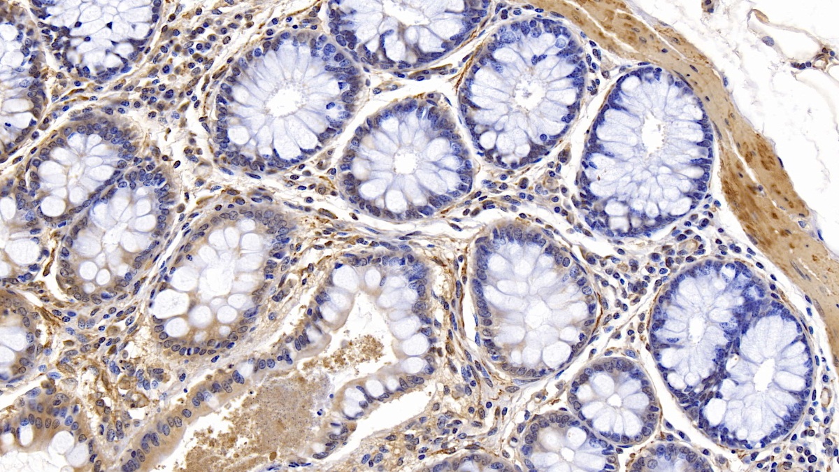 Monoclonal Antibody to Actin Alpha 1, Cardiac Muscle (ACTC1)