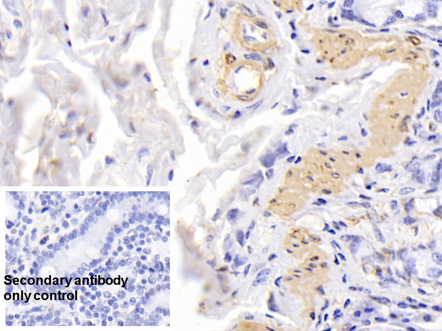 Monoclonal Antibody to Actin Alpha 1, Cardiac Muscle (ACTC1)