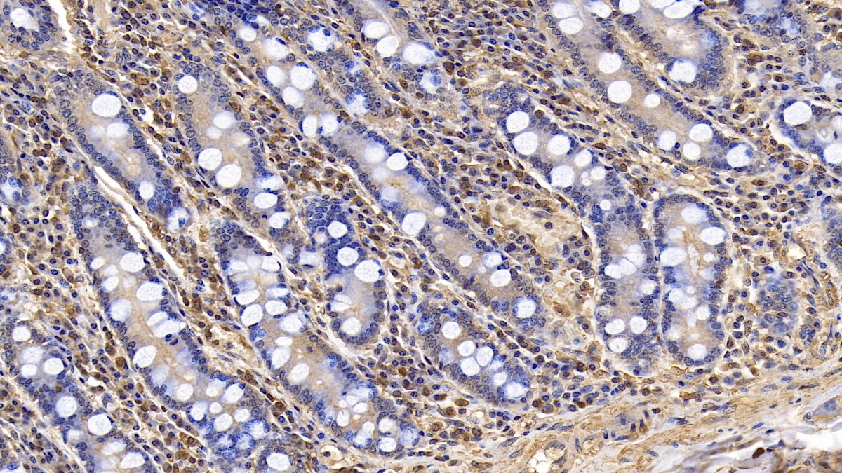 Monoclonal Antibody to Actin Alpha 1, Cardiac Muscle (ACTC1)