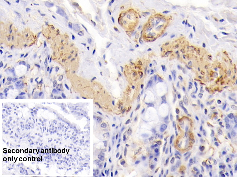 Monoclonal Antibody to Actin Alpha 1, Cardiac Muscle (ACTC1)