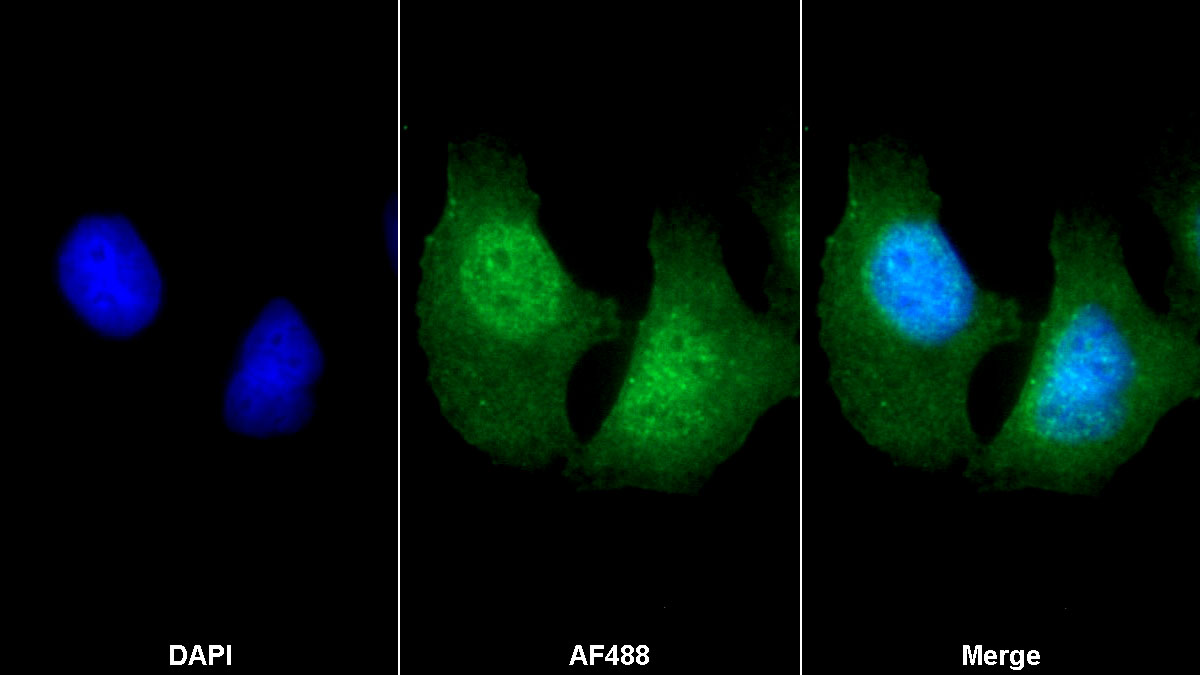 Monoclonal Antibody to Actin Alpha 2, Smooth Muscle (ACTa2)