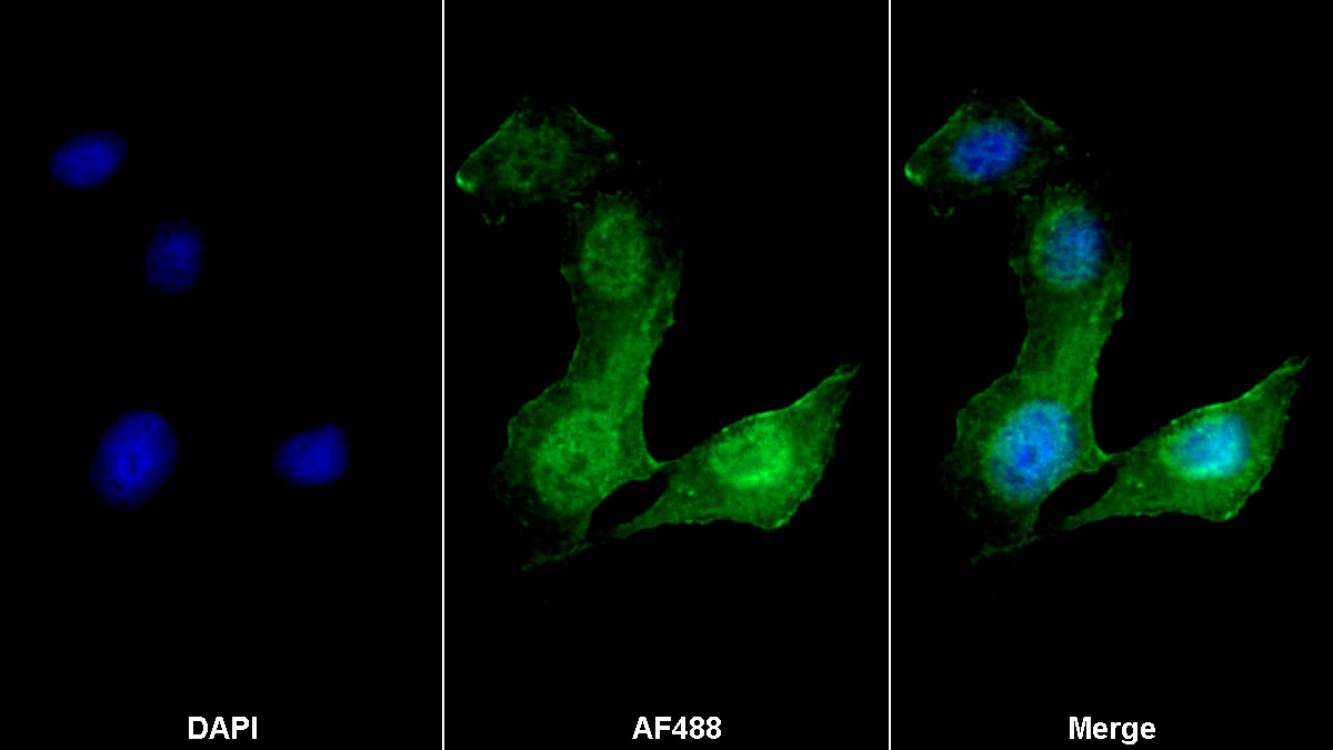 Monoclonal Antibody to Actin Alpha 2, Smooth Muscle (ACTa2)