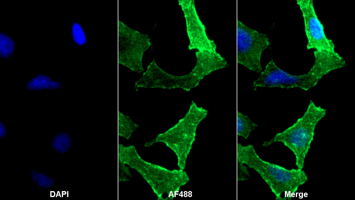 Monoclonal Antibody to Actin Alpha 2, Smooth Muscle (ACTa2)