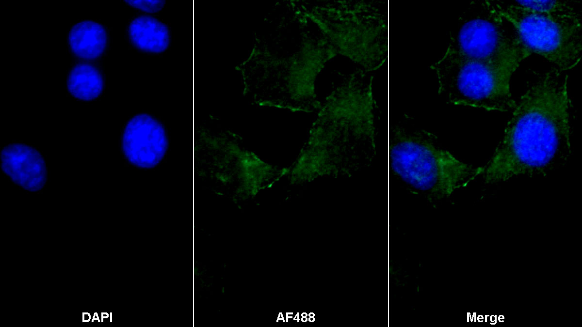 Monoclonal Antibody to Actin Alpha 2, Smooth Muscle (ACTa2)