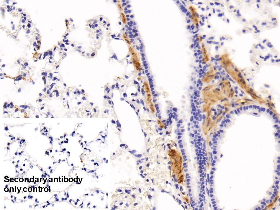 Monoclonal Antibody to Actin Alpha 2, Smooth Muscle (ACTa2)