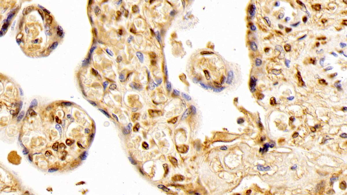 Monoclonal Antibody to Aryl Hydrocarbon Receptor (AhR)