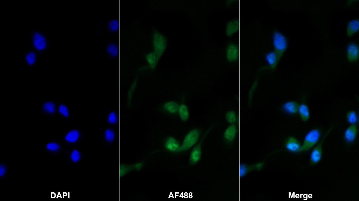 Monoclonal Antibody to Aryl Hydrocarbon Receptor (AhR)