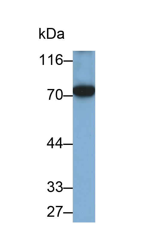 Monoclonal Antibody to 5-Lipoxygenase (5-LO)