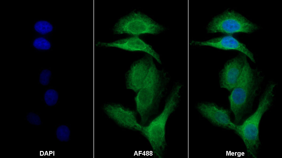 Monoclonal Antibody to 5-Lipoxygenase (5-LO)