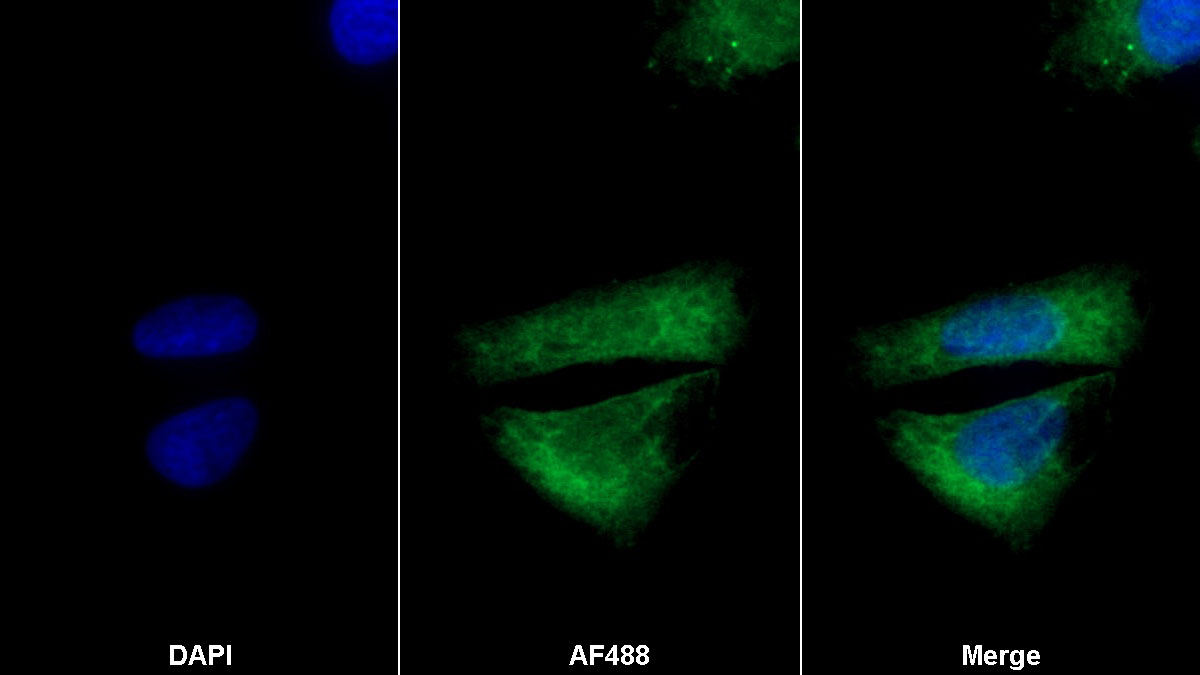 Monoclonal Antibody to 5-Lipoxygenase (5-LO)