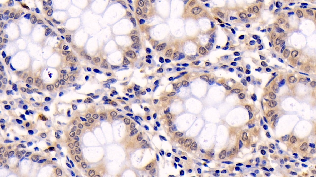 Monoclonal Antibody to Extracellular Signal Regulated Kinase 1 (ERK1)