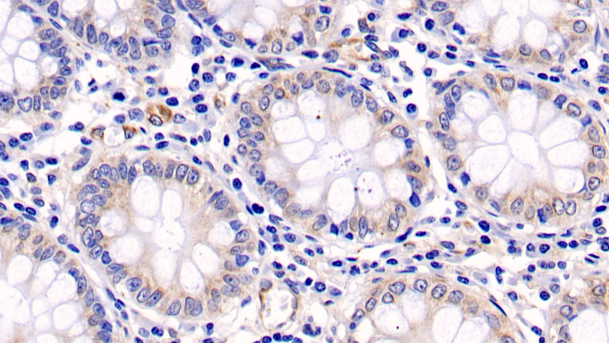 Monoclonal Antibody to Extracellular Signal Regulated Kinase 1 (ERK1)