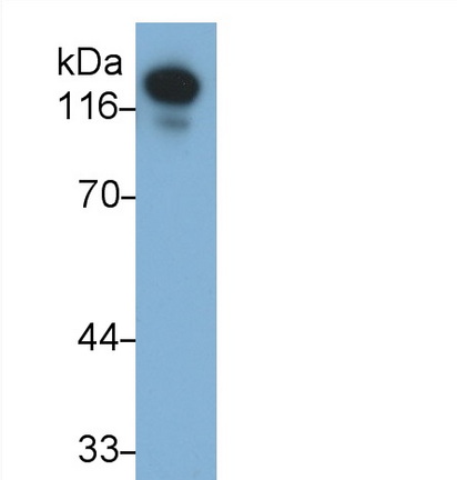 Monoclonal Antibody to Cadherin 5 (CDH5)