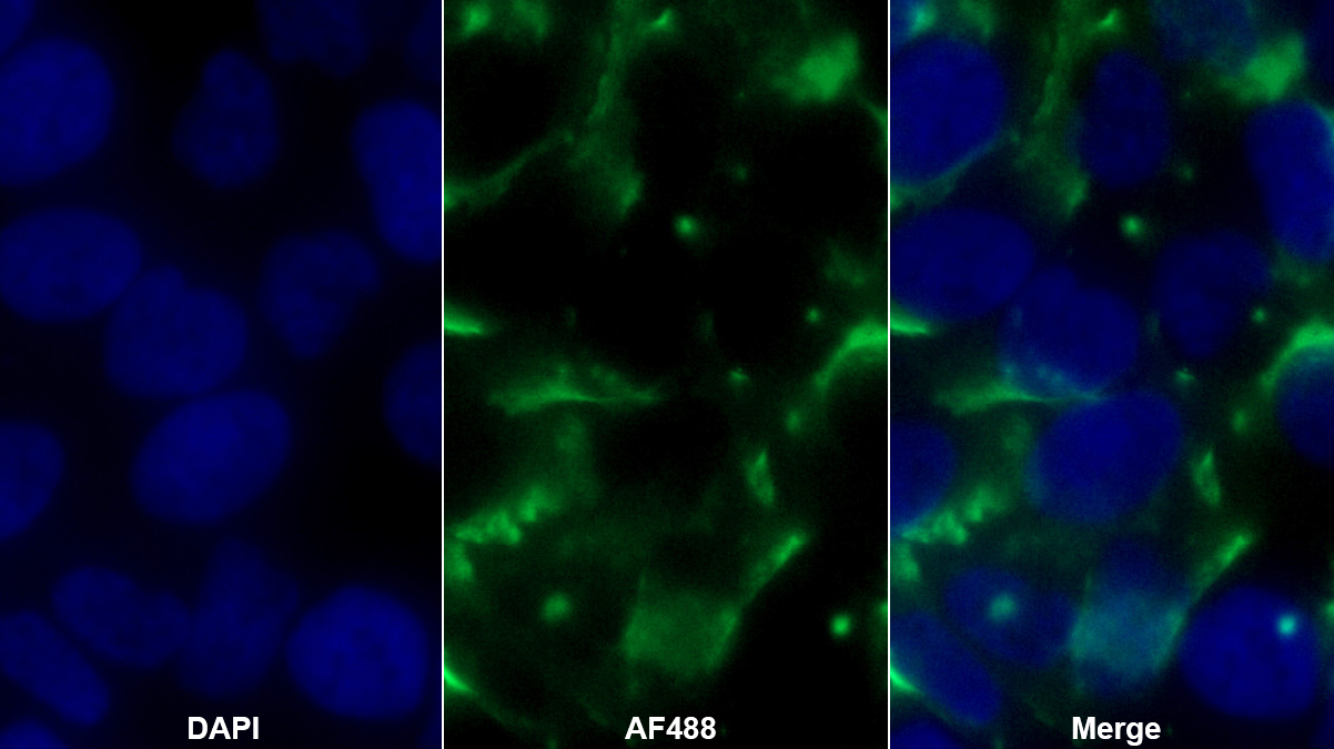 Monoclonal Antibody to Serpin B3 (SERPINB3)