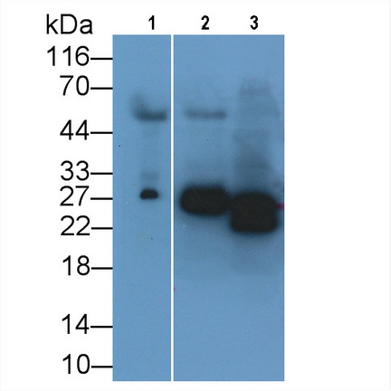 Monoclonal Antibody to Neutrophil gelatinase-associated lipocalin (NGAL)