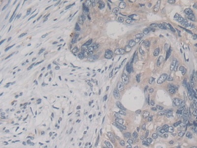 Monoclonal Antibody to Neutrophil gelatinase-associated lipocalin (NGAL)