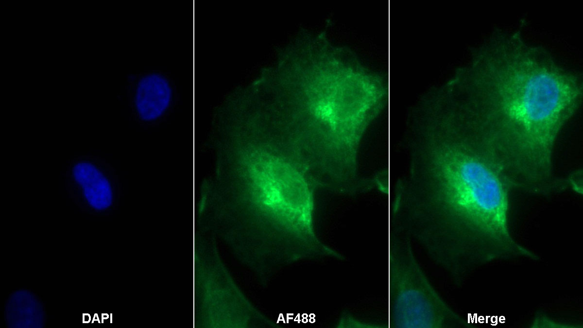 Monoclonal Antibody to Neutrophil gelatinase-associated lipocalin (NGAL)