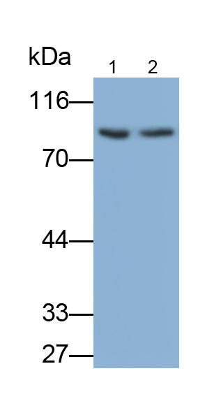 Monoclonal Antibody to Interferon Alpha/Beta Receptor 1 (IFNa/bR1)