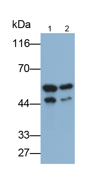 Monoclonal Antibody to Interferon Alpha/Beta Receptor 1 (IFNa/bR1)