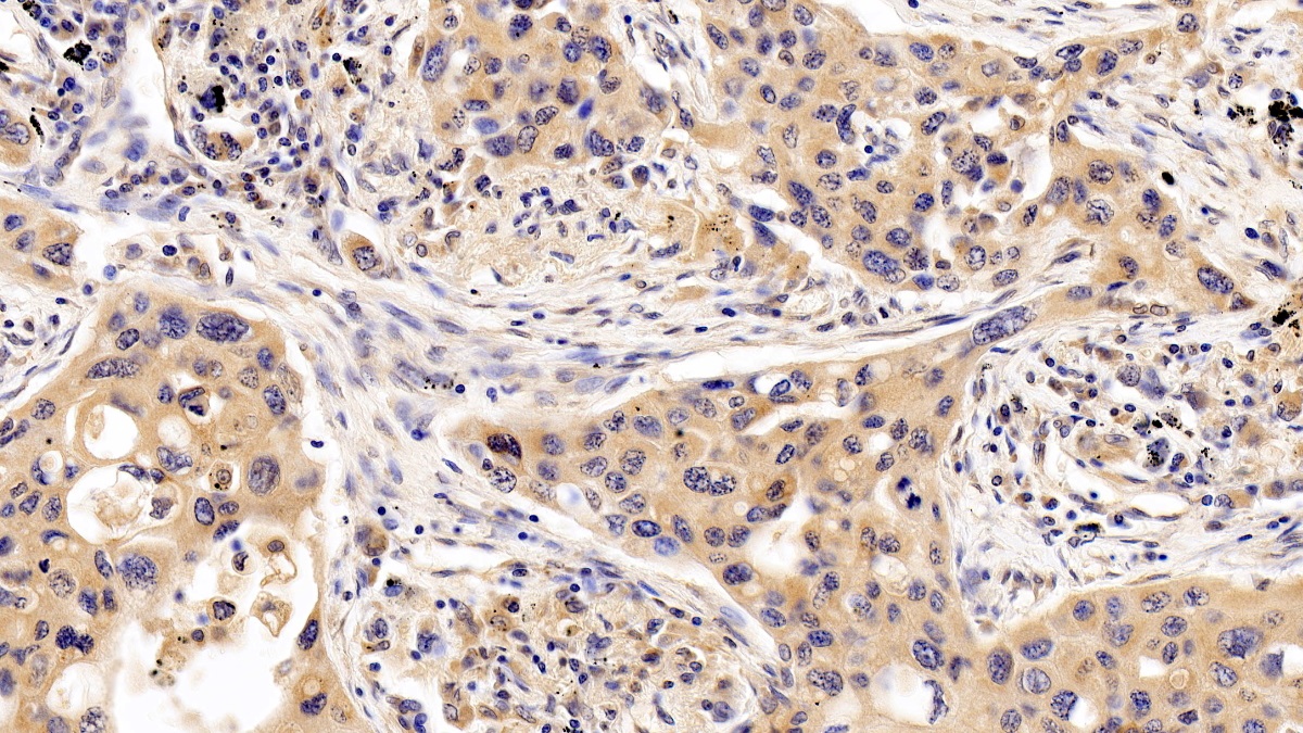 Monoclonal Antibody to Interferon Alpha/Beta Receptor 1 (IFNa/bR1)