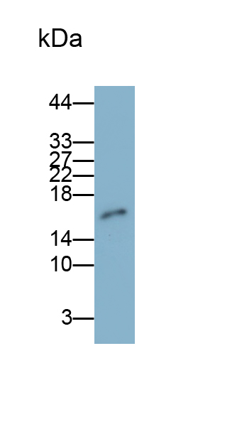 Monoclonal Antibody to Matrix Gla Protein (MGP)