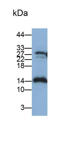 Monoclonal Antibody to Matrix Gla Protein (MGP)