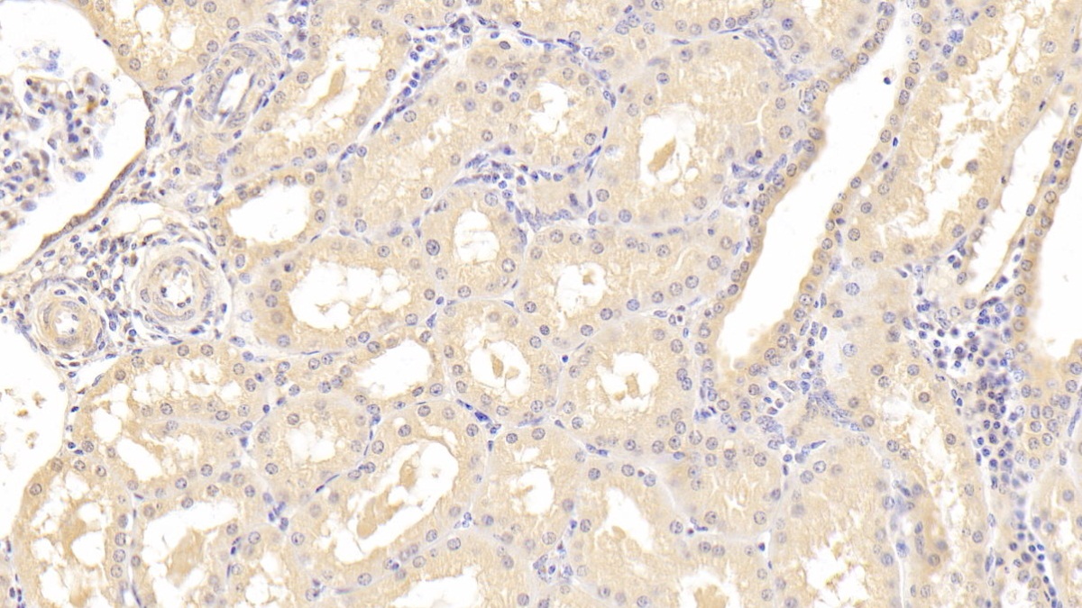 Monoclonal Antibody to Heparin Binding Epidermal Growth Factor Like Growth Factor (HBEGF)