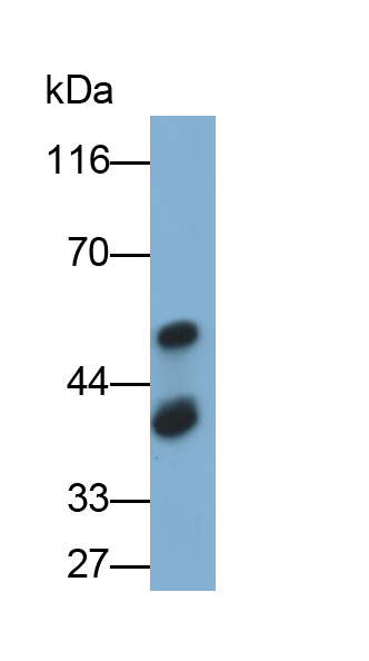 Monoclonal Antibody to Salivary Alpha Amylase (AMY1A)