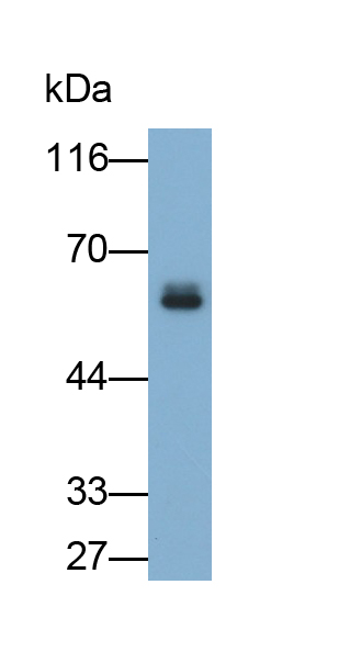 Monoclonal Antibody to Salivary Alpha Amylase (AMY1A)