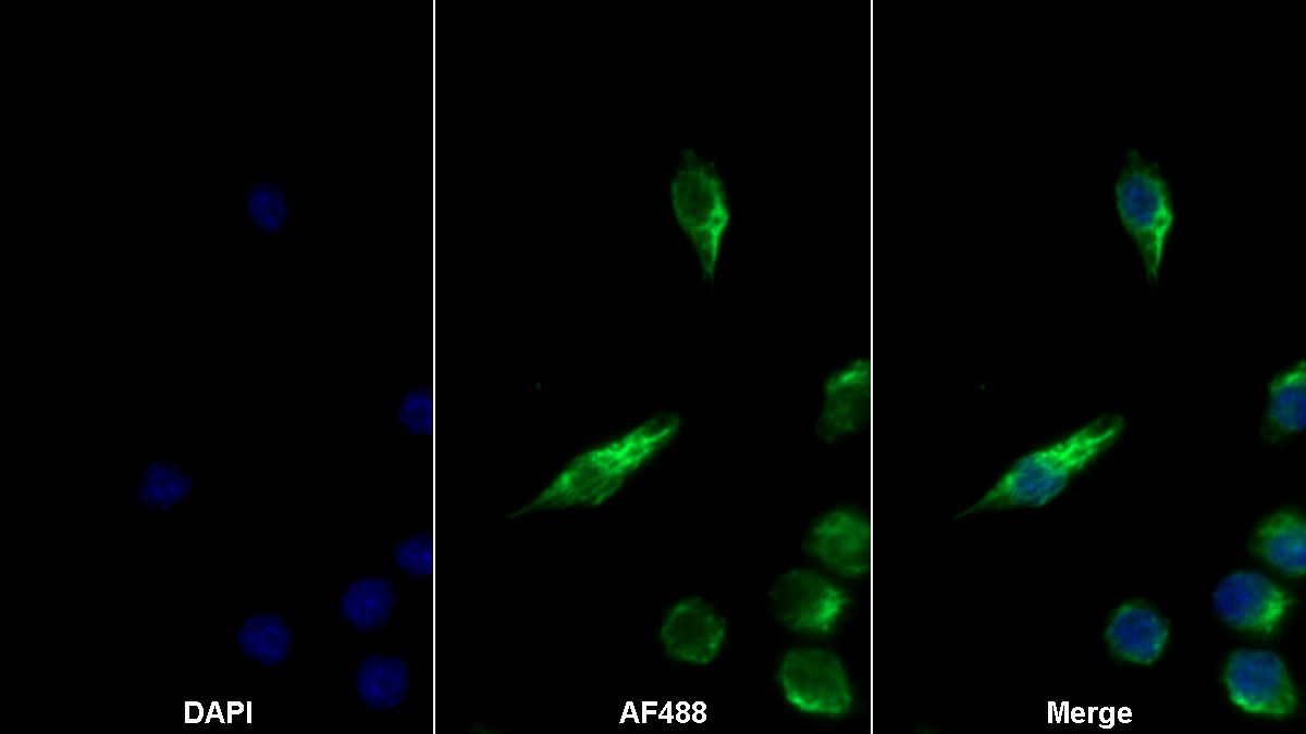 Monoclonal Antibody to Colony Stimulating Factor Receptor, Macrophage (MCSFR)