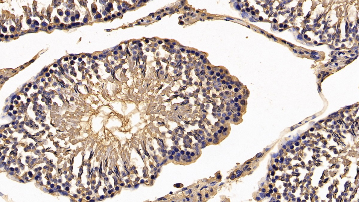 Monoclonal Antibody to Calreticulin (CALR)