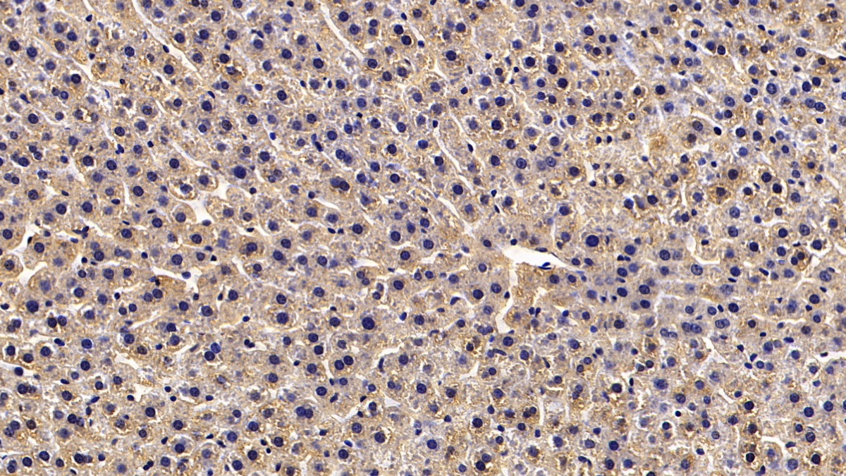 Monoclonal Antibody to Calreticulin (CALR)