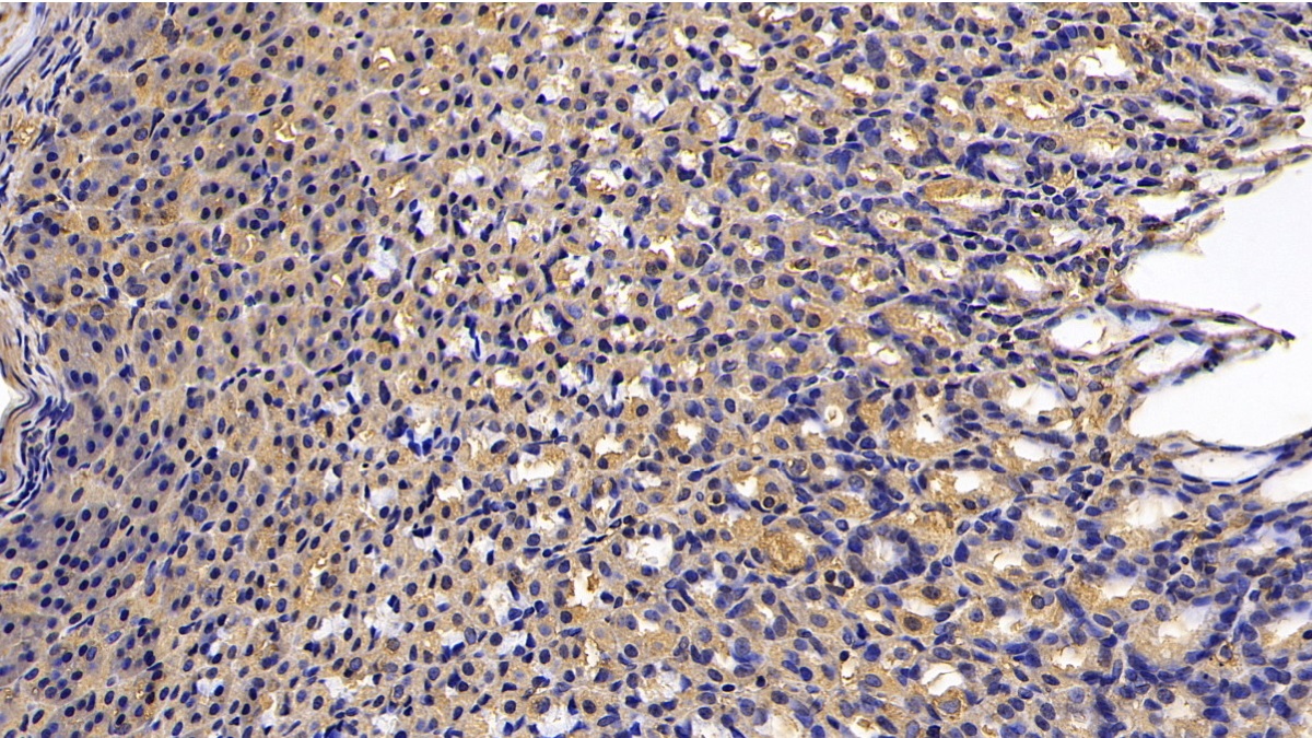 Monoclonal Antibody to Calreticulin (CALR)