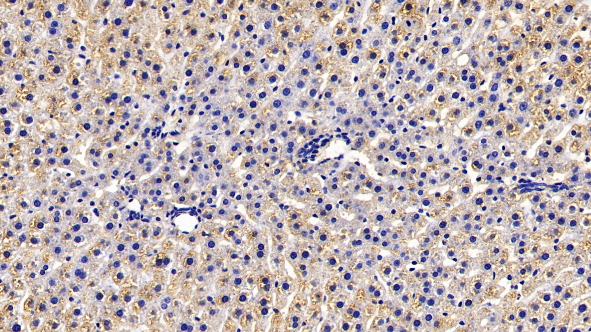 Monoclonal Antibody to Calreticulin (CALR)