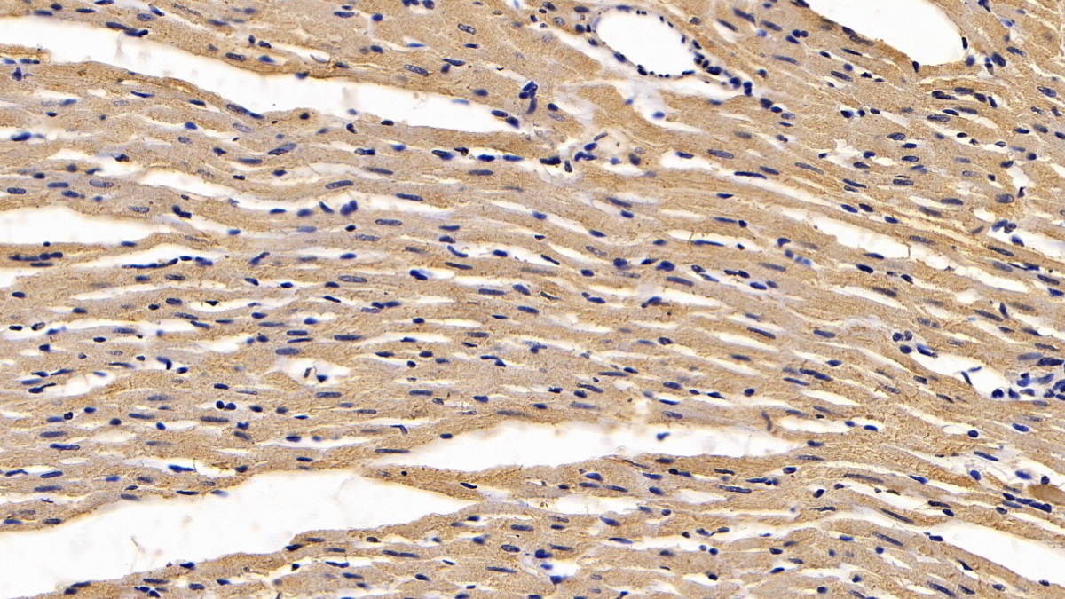 Monoclonal Antibody to Calreticulin (CALR)