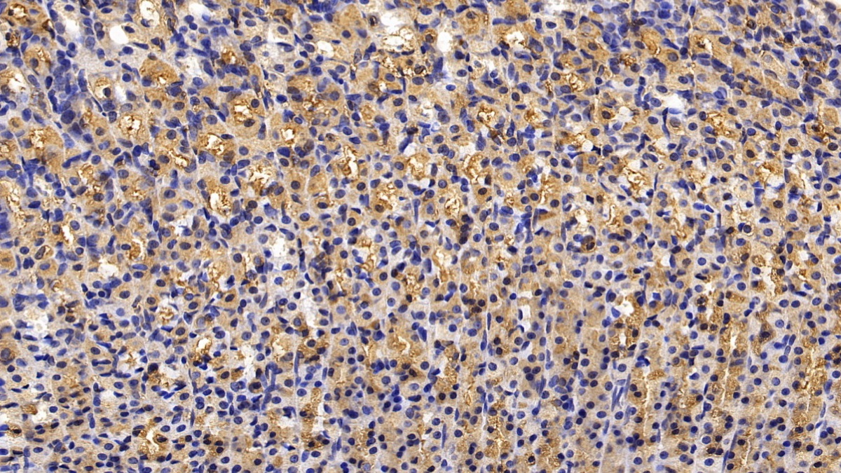 Monoclonal Antibody to Calreticulin (CALR)