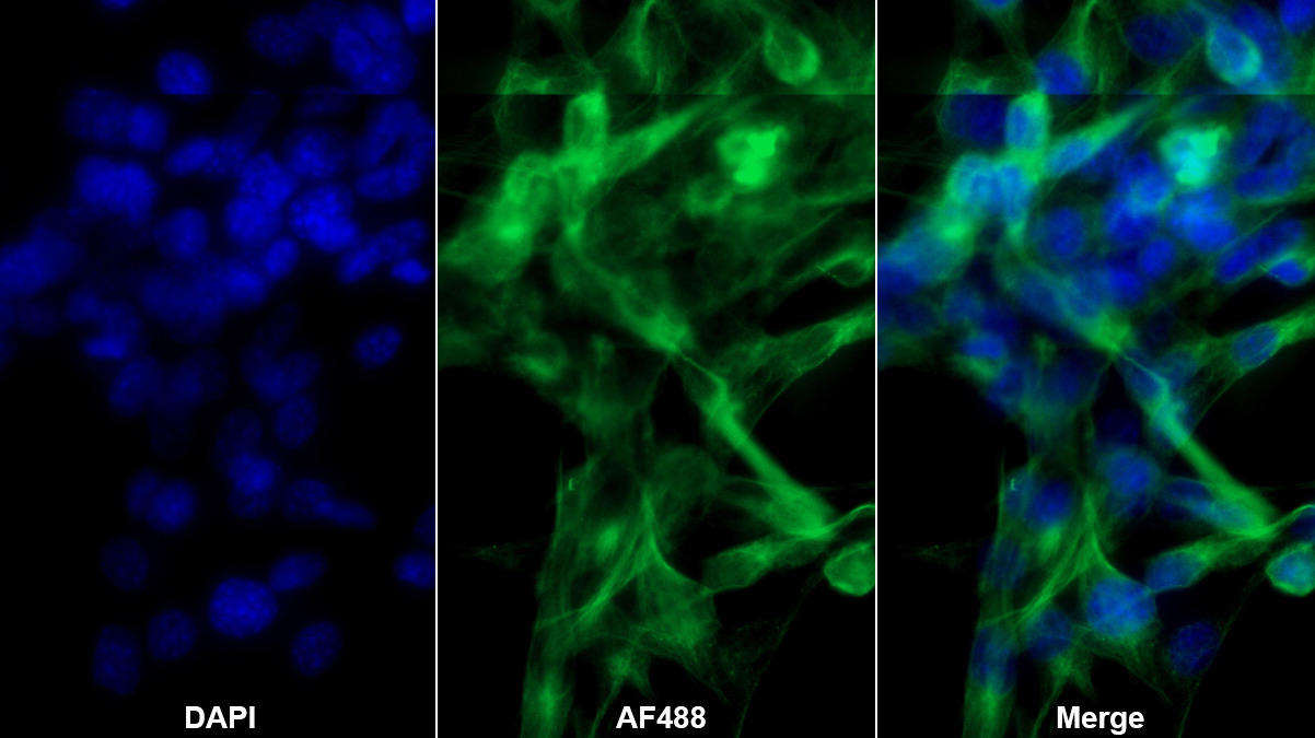 Monoclonal Antibody to Calreticulin (CALR)