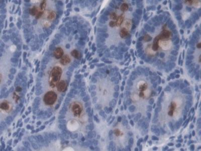 Monoclonal Antibody to Lipopolysaccharide (LPS)